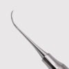 Nevi 3 Posterior
